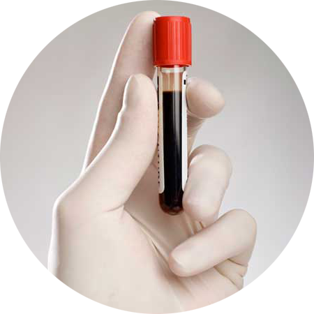 Антитела к вирусу гепатита С (anti-HCV IgM)