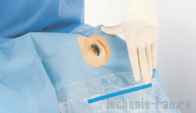 Комплект стерильный для офтальмологических  операций