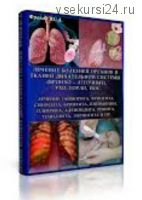 Лечение болезней органов и тканей дыхательной системы. Инфопродукт №18, 2015 (Юрий Фролов)