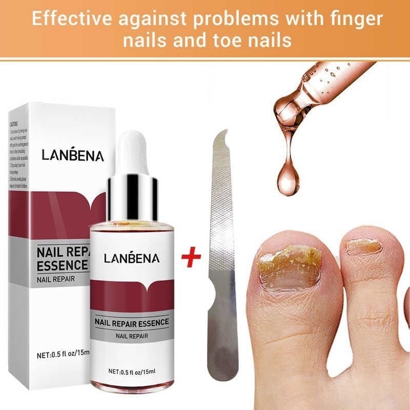 Противогрибковые средства для ногтей LANBENA Nail Repair Essence, 15мл (е190)