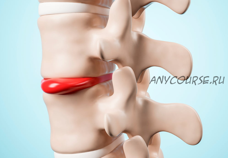 [Wellcom] Реабилитационный фитнес при межпозвонковых грыжах (Эльмира Хабибуллина)