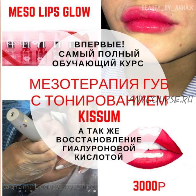 [beauty_shop.bb_glow] Мезотерапия губ с тонированием KISSUM (Анна Караваева)